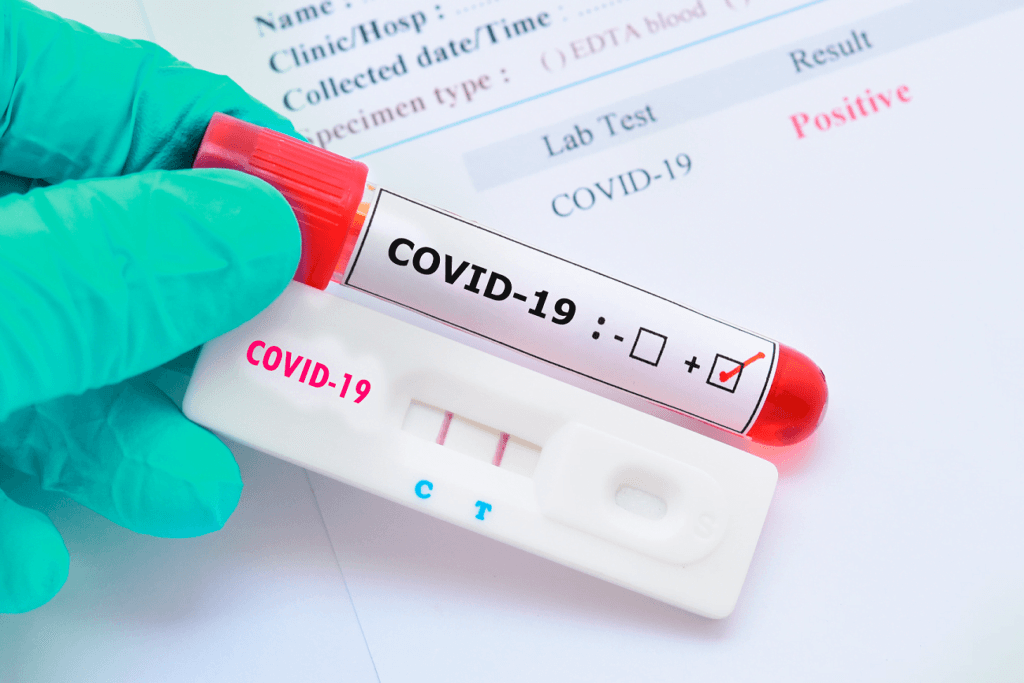 Amazonas bate recorde com mais de 7 mil novos casos de Covid-19 em 24h