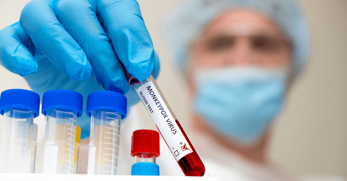 Brasil tem 37 casos de varíola dos macacos, e Fiocruz conclui sequenciamento do vírus