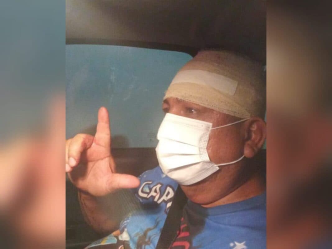 Bolsonarista agride assessor de Zé Ricardo em comício na Redenção