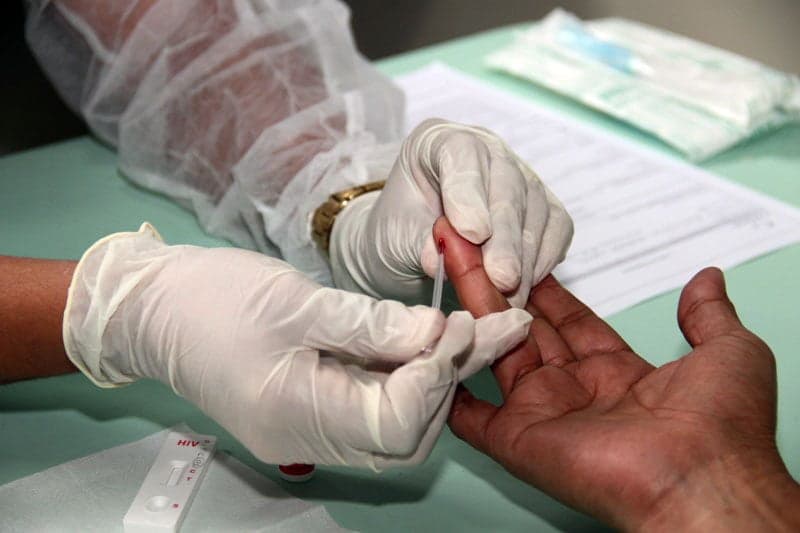 Estudo aponta para aumento alarmante do HIV no Brasil, acima dos limites da OMS