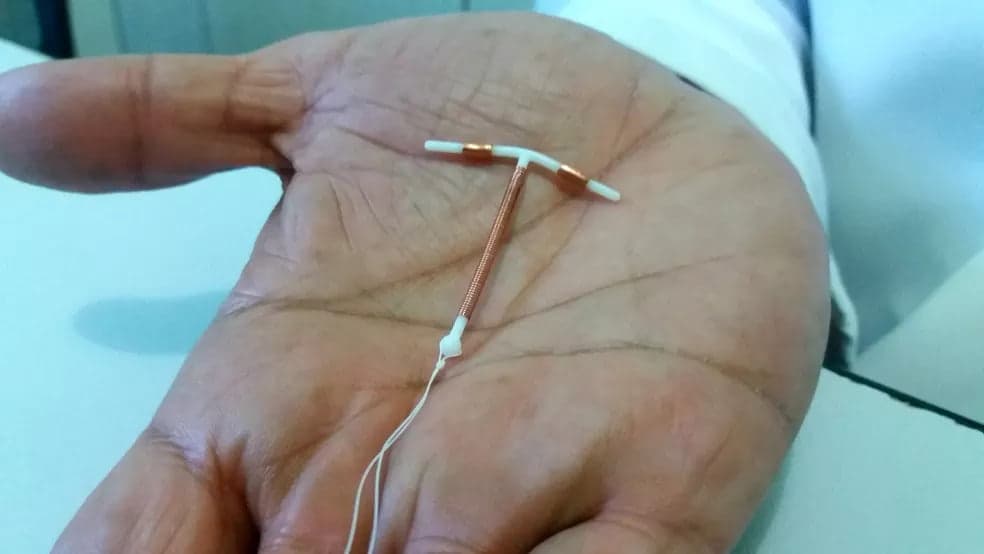 Manaus começa a ofertar implantação de DIU em UBSs; veja lista