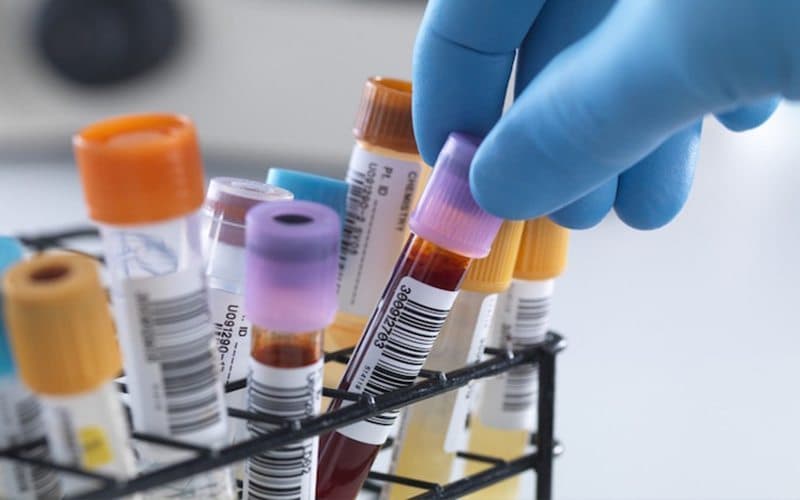 Anvisa autoriza realização de exame de análise clínica em farmácias