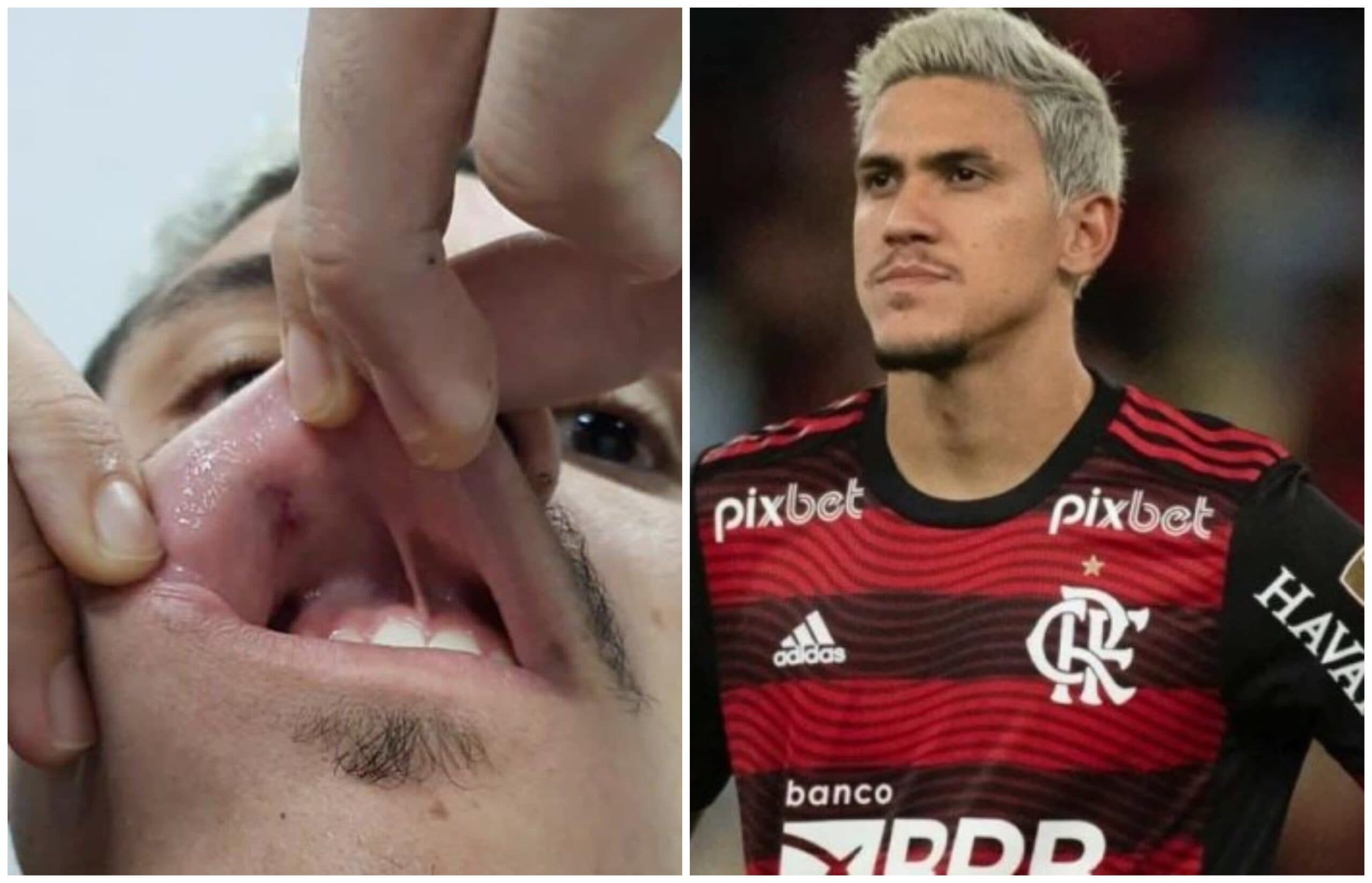 Briga no Flamengo: Pedro registra B.O após receber soco de preparador físico