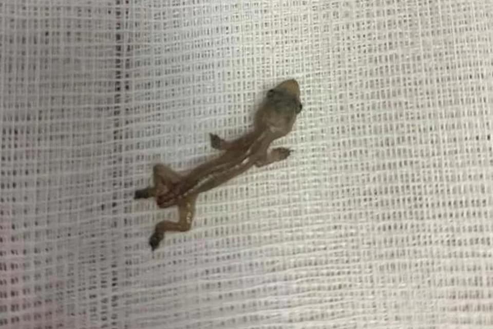 Menino é internado em estado grave após madrasta o obrigar a comer lagartixa