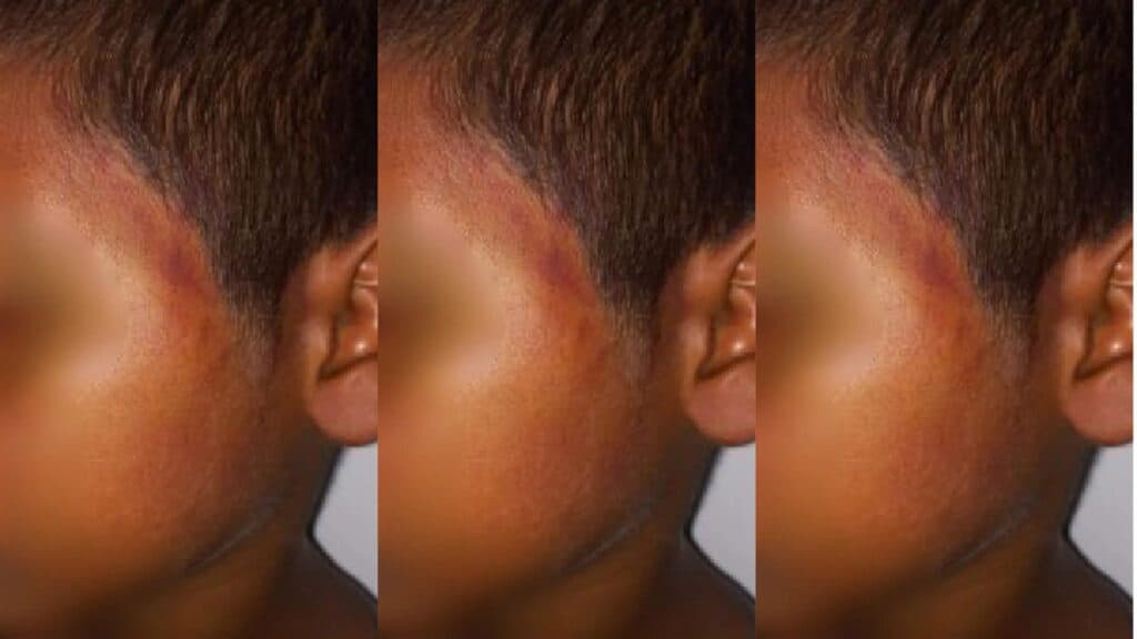 Criança de 10 anos é espancada pelo próprio tio com golpes de sandália, em Roraima