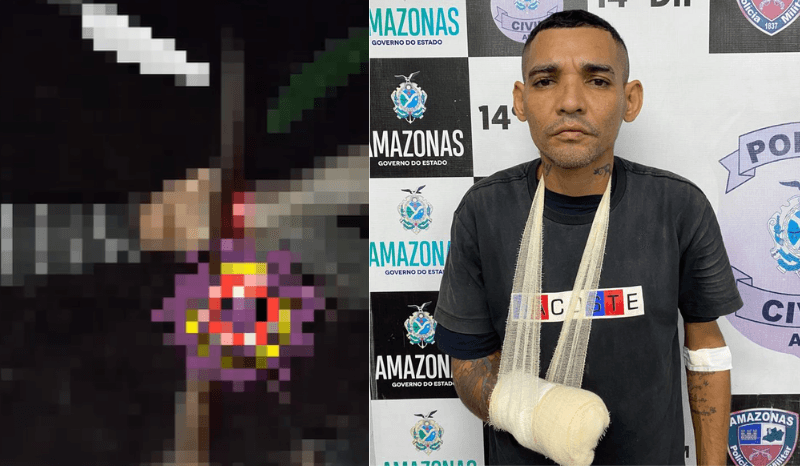 VÍDEO: homem tem a mão decepada com terçado pelo &#8220;Tribunal do Crime&#8221;