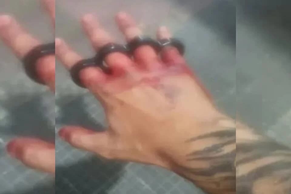 “Justiceiros” de Copacabana compartilham foto com mão ensanguentada e soco-inglês