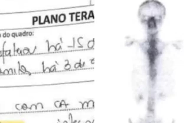 Após fazer quimioterapia por seis anos, mulher descobre nunca ter tido câncer