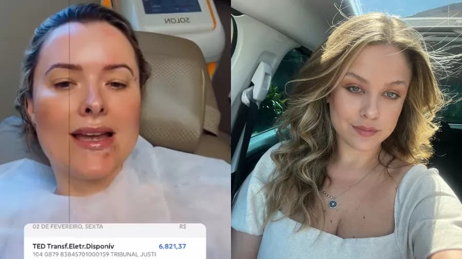 Deputada de SC ganha ação movida contra vereadora e gasta indenização com botox