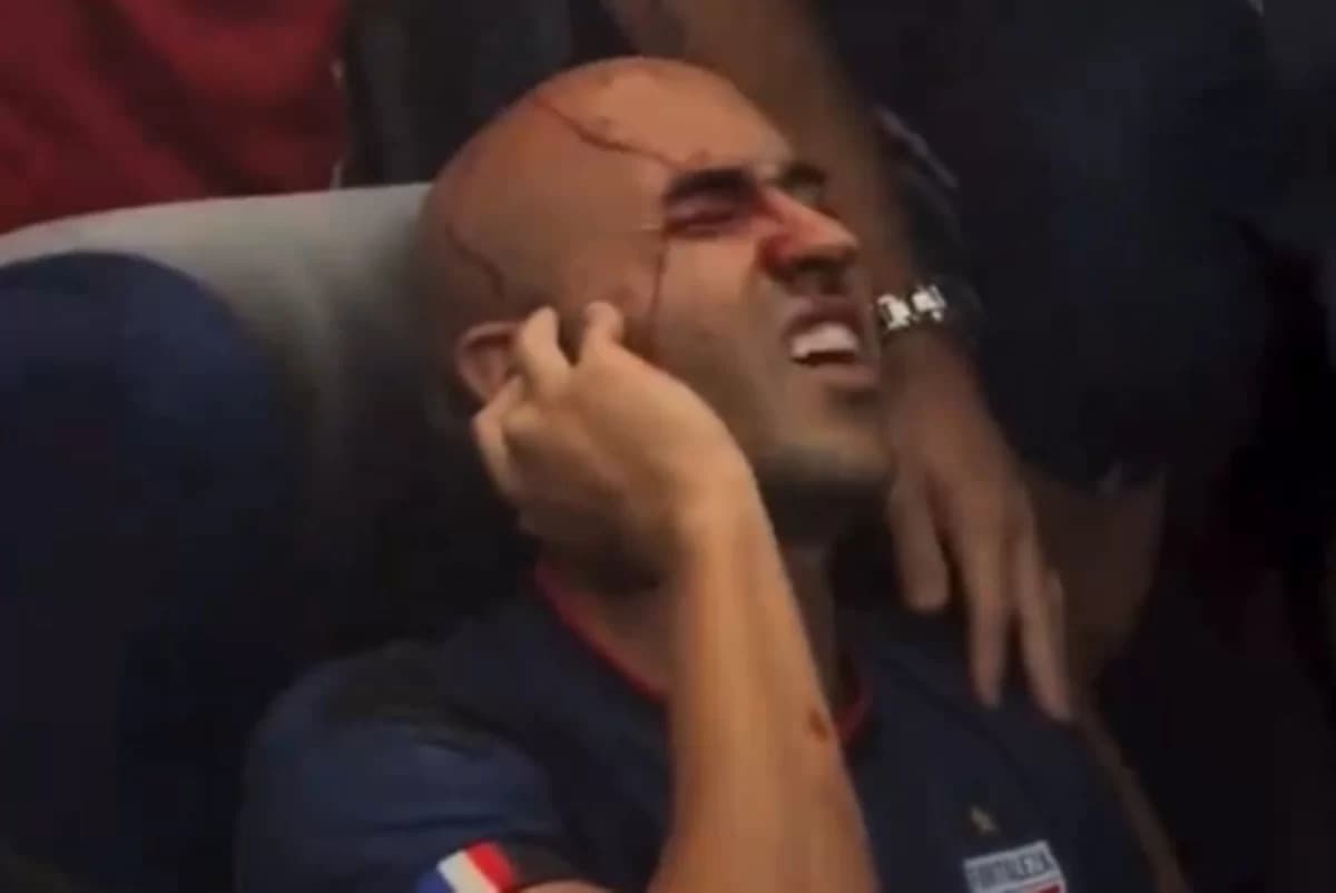 VÍDEOS: Seis jogadores do Fortaleza ficam feridos após ônibus do time ser apedrejado