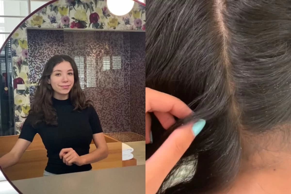 Australiana ganha cerca de R$ 750 por hora para catar piolhos e lêndeas