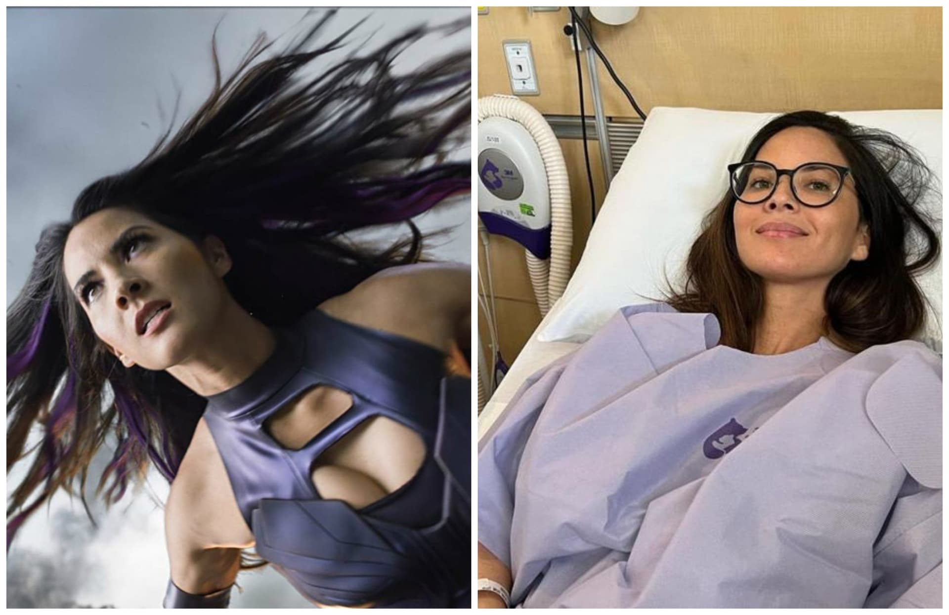 Atriz de &#8216;X-Men: Apocalipse&#8217; revela diagnóstico de câncer agressivo de mama