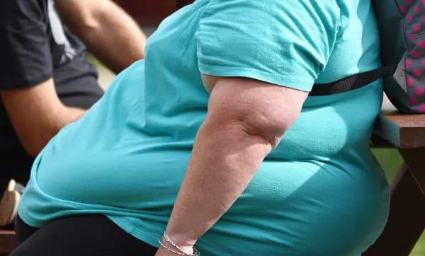 Uma em cada oito pessoas no mundo é obesa, alerta OMS