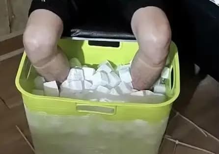 Homem é acusado de provocar amputação para receber R$ 6,5 milhões, em Tawain