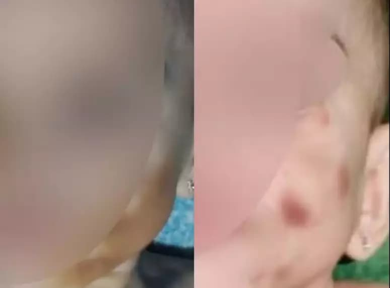 Presa por maus-tratos, mulher usava maquiagem para esconder hematomas em bebê de 1 ano em MT