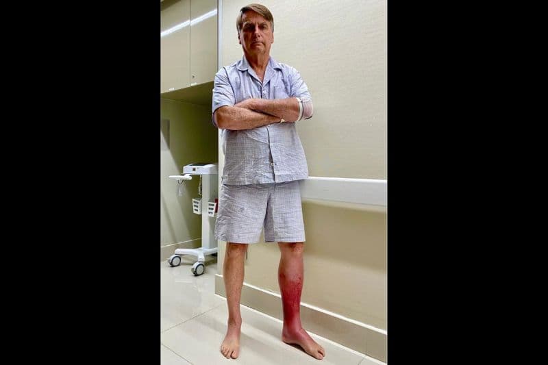 VÍDEO: Bolsonaro permanece sem previsão de alta e volta a caminhar em hospital