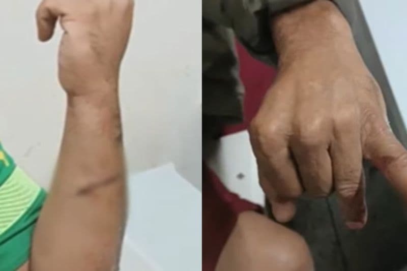 Briga entre compadres antes de batizado dos filhos acaba em facada e mordida na Paraíba