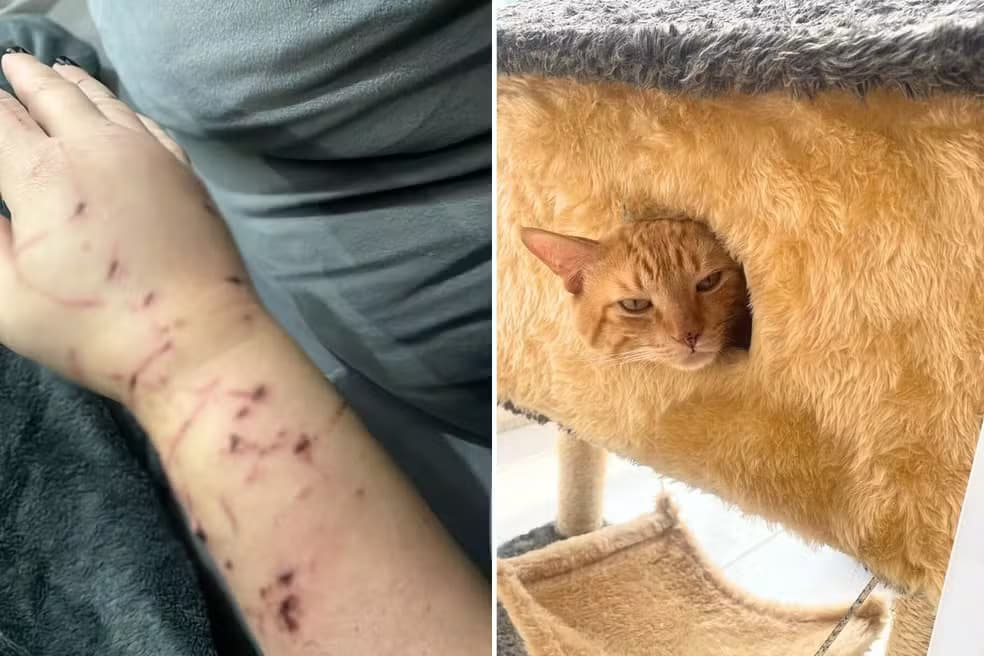 SP: Gato dilacera braço de tutora e faz família de “refém” dentro da própria casa