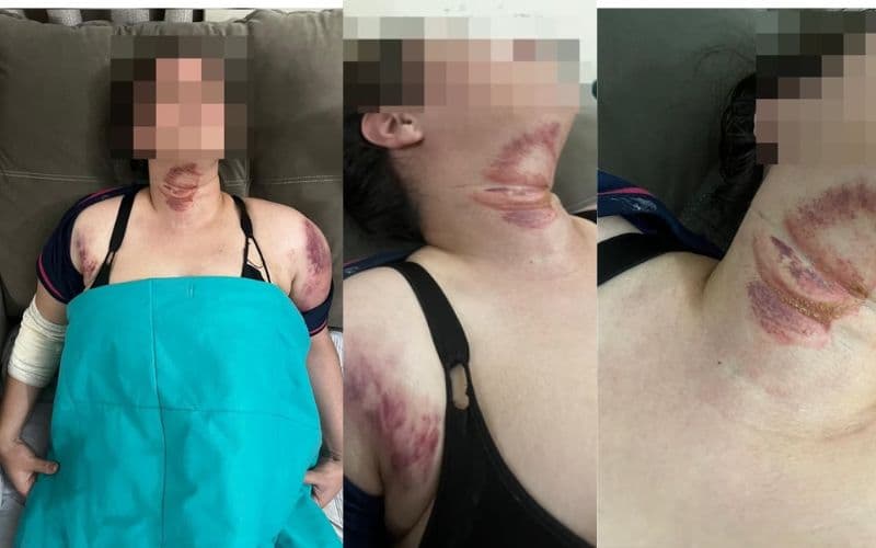 Vídeo: fio solto corta pescoço e derruba mulher de garupa de moto