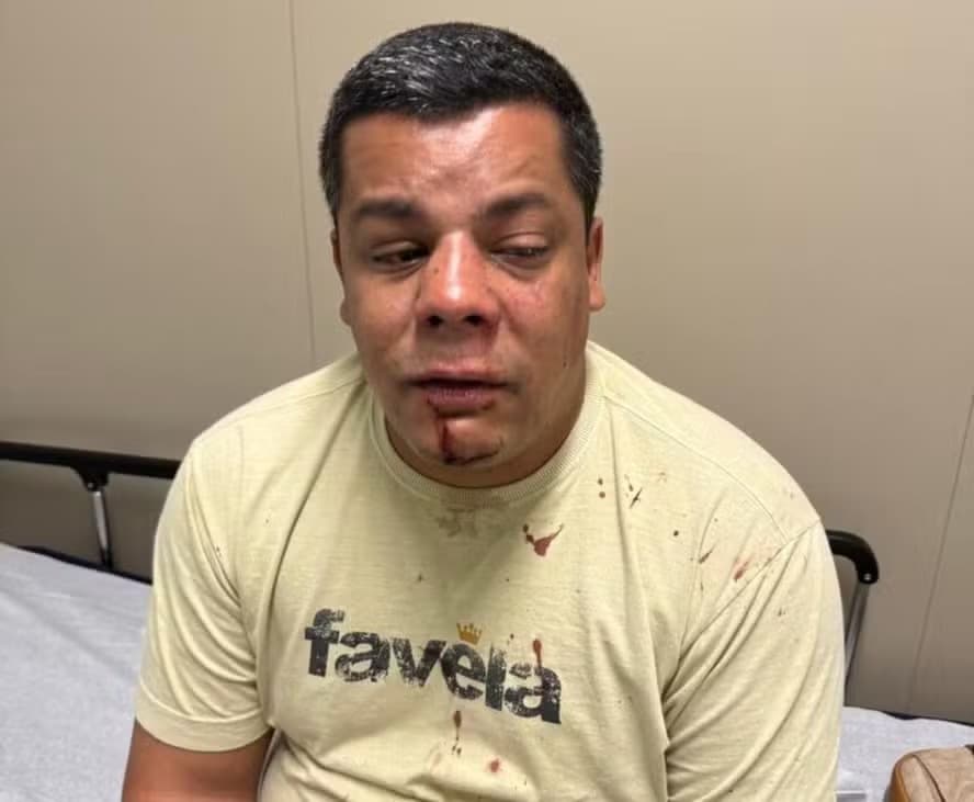 RJ: Candidato a vereador recebe alta após agressão envolvendo deputado