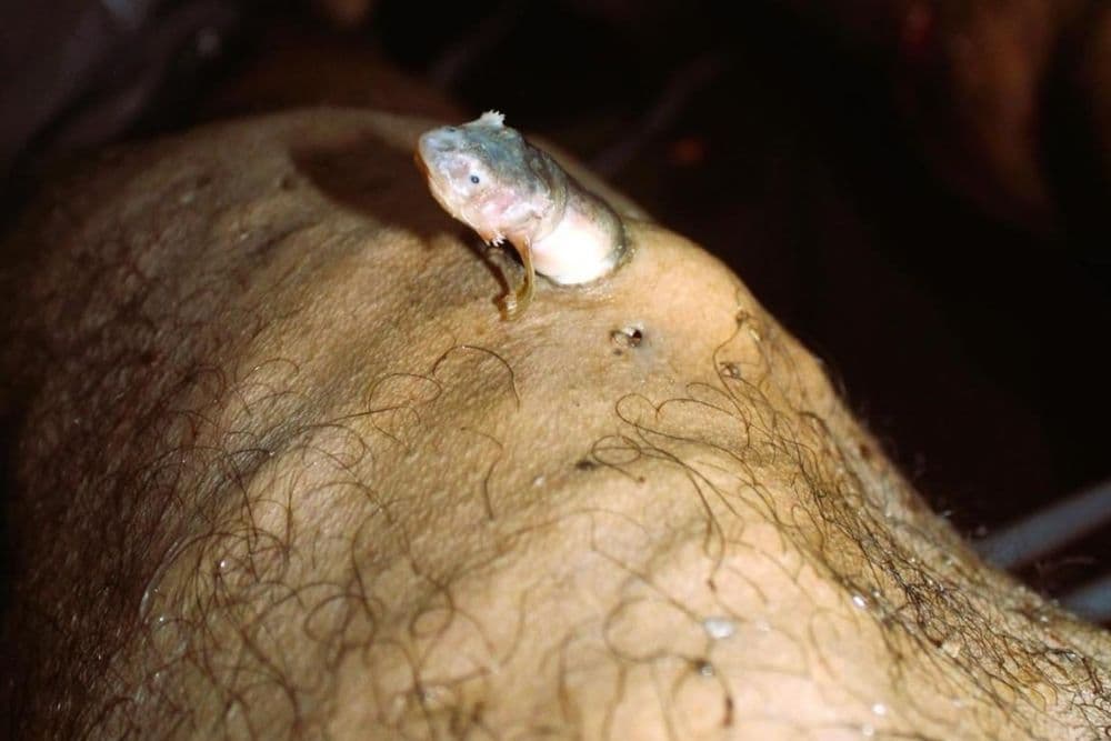 Perita do IML Manaus vence concurso nacional com foto de candiru em cadáver