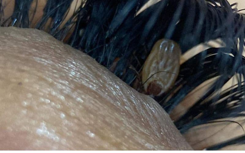 Bizarro: Designer de sobrancelhas encontra carrapato em cílios de cliente