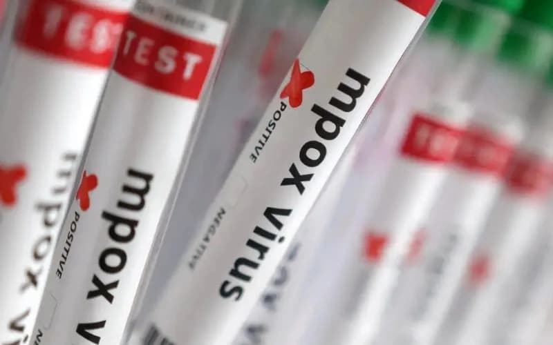 Estados Unidos confirmam primeiro caso de nova variante da Mpox