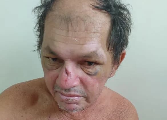 Hospital João Lúcio pede ajuda para localizar familiares de paciente vítima de atropelamento