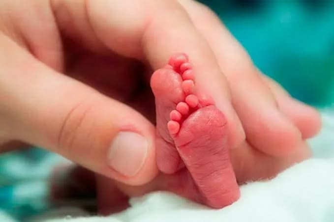 Brasil: Taxa de nascimentos prematuros está acima da média global