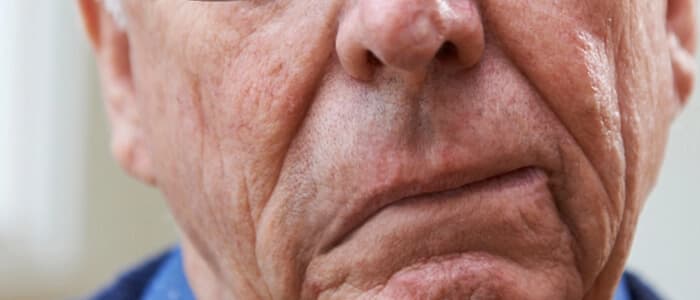 Conheça os 6 sintomas mais comuns de AVC para ficar alerta