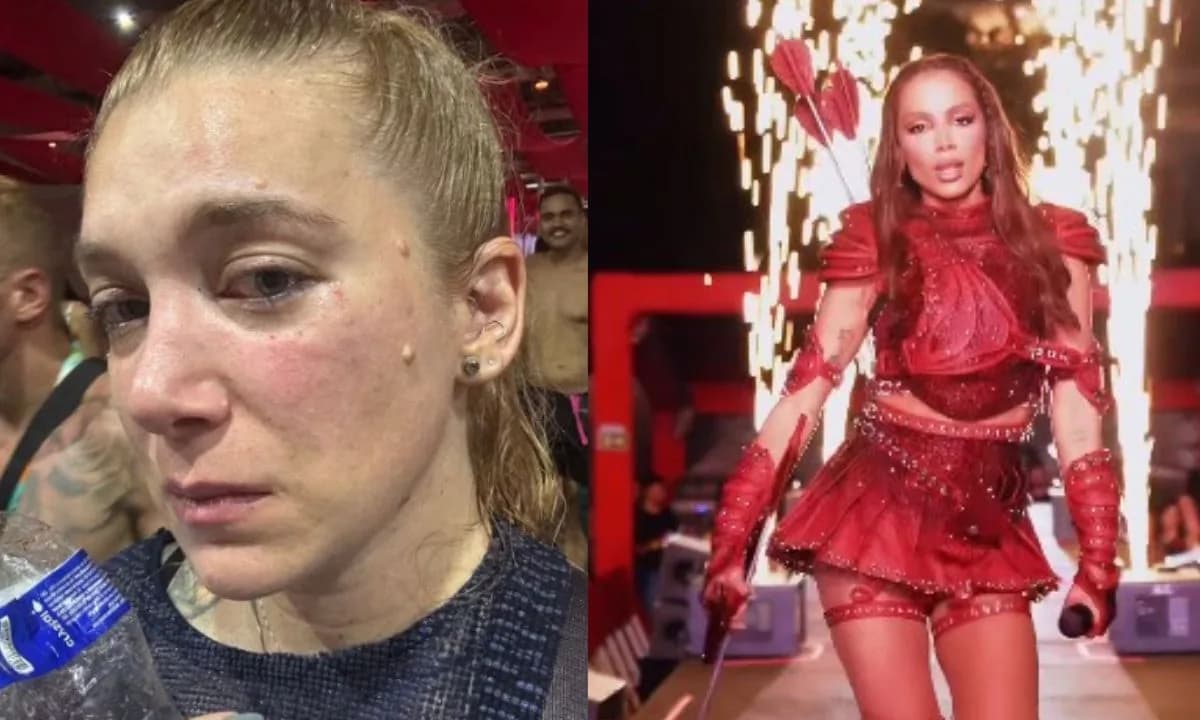 Mulher leva soco durante show de Anitta e diz que foi motivado por homofobia