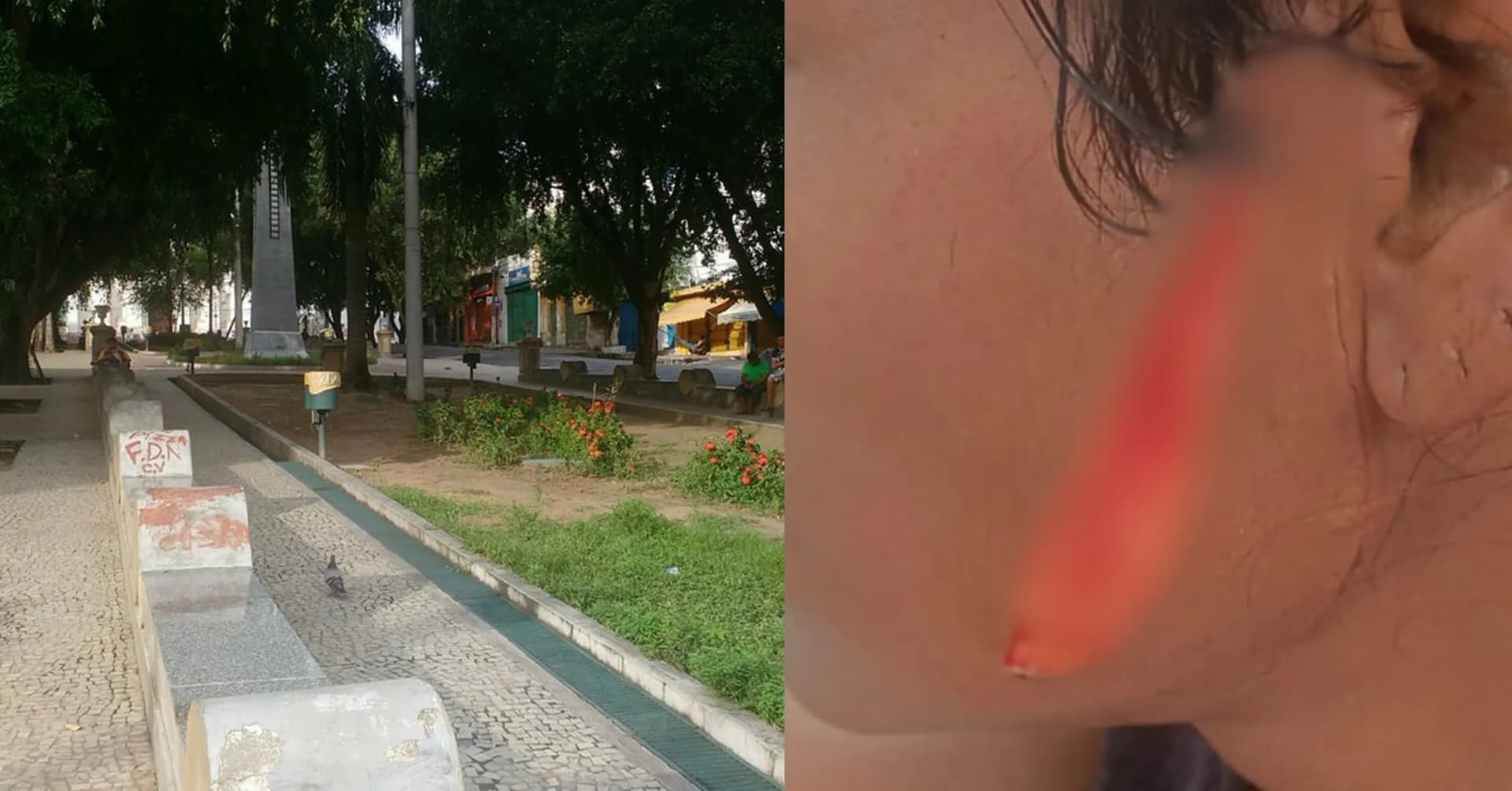 Briga por desafeto amoroso termina com rosto cortado no Centro de Manaus