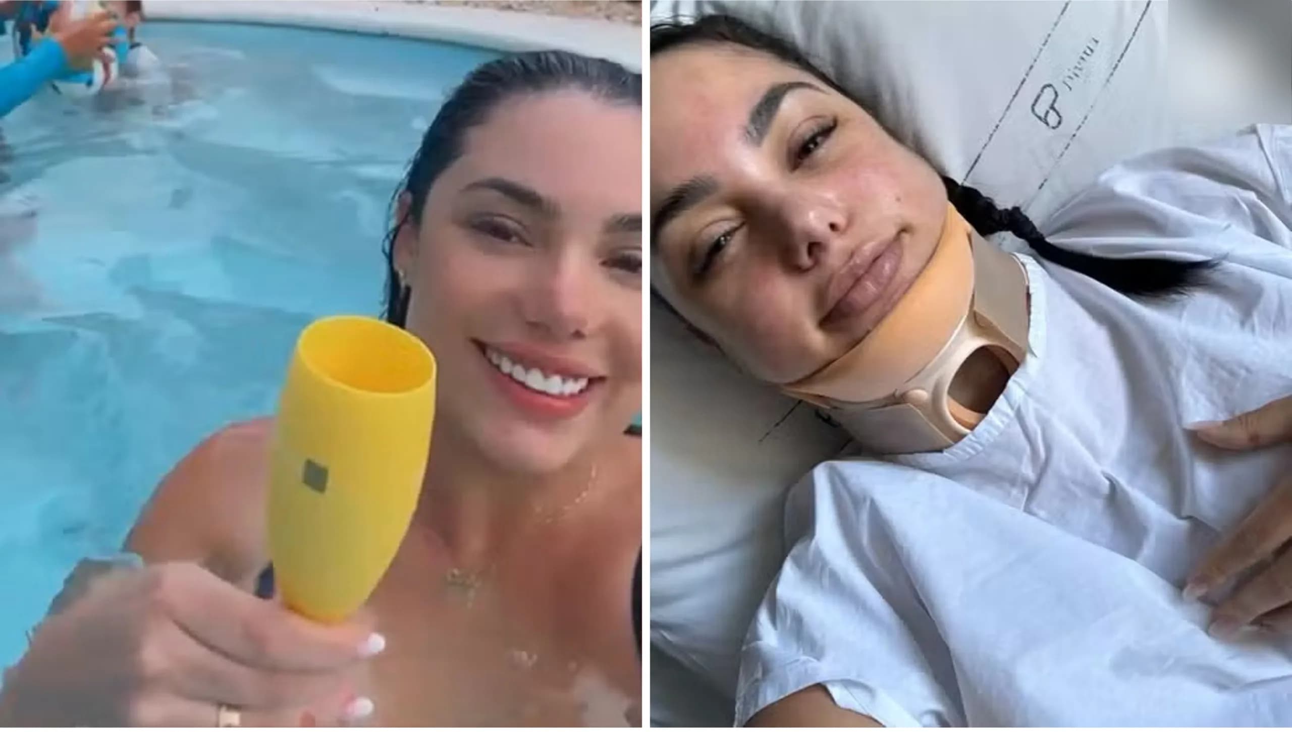 Mulher tem o cabelo preso em sugador de piscina e fica com cervical quebrada no RS