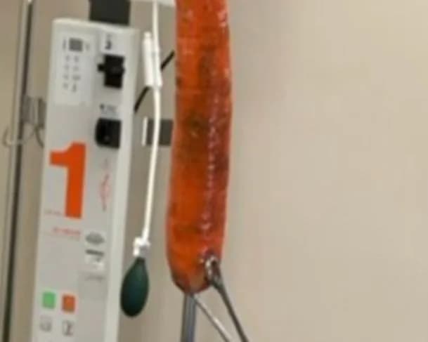 Médico faz apelo após homem ser hospitalizado com cenoura presa no reto