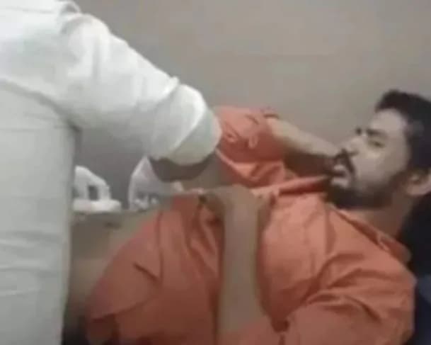 Tutorial do YouTube: homem faz cirurgia nele mesmo assistindo vídeos