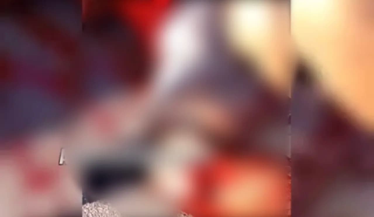 IMAGENS FORTES: carro atropela pedestre em marcha à ré e deixa vítima com perna dilacerada em Caicó (RN)