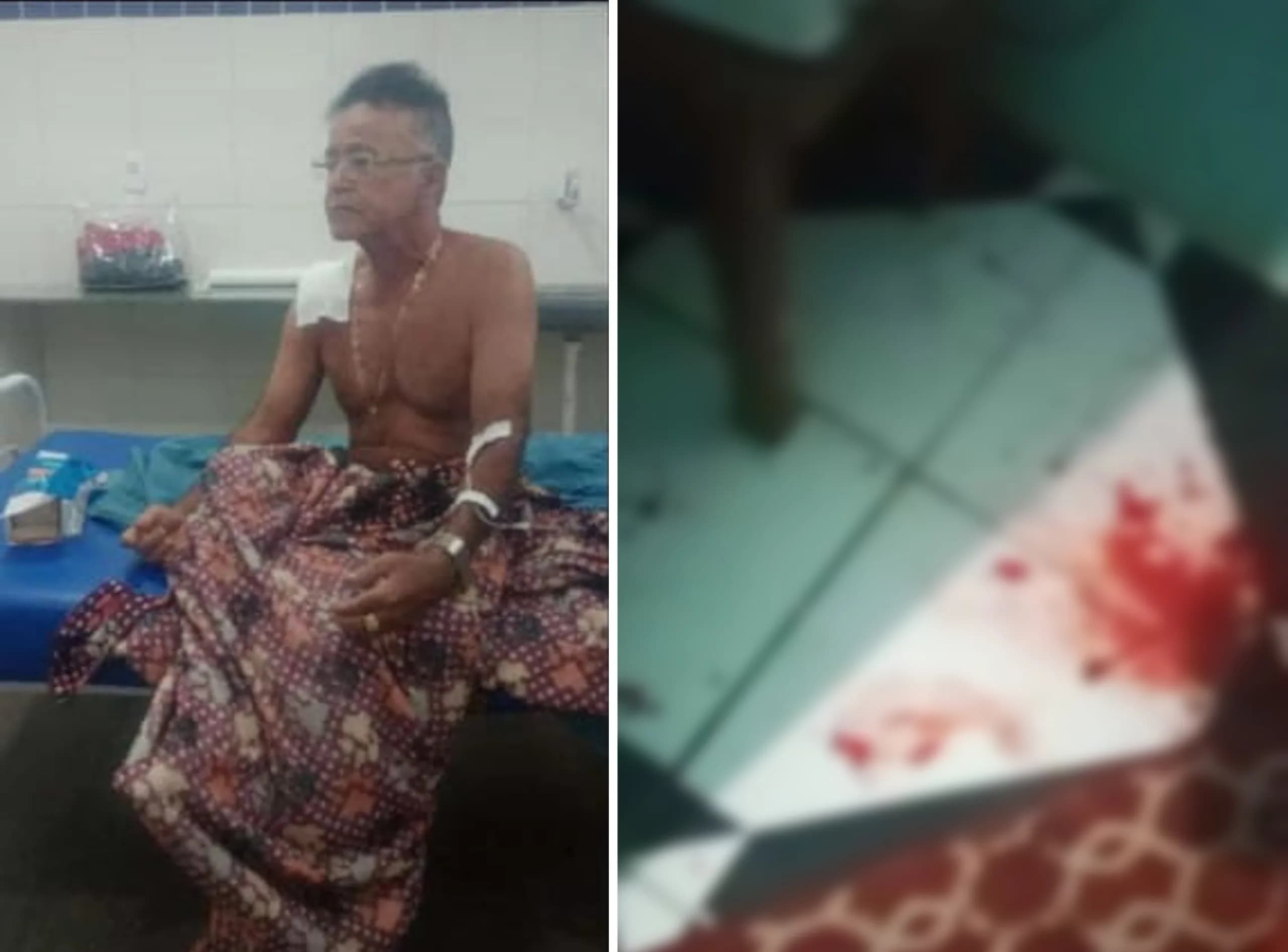 VÍDEO: Idoso de 72 anos é esfaqueado durante assalto e dois suspeitos são presos em Maraã