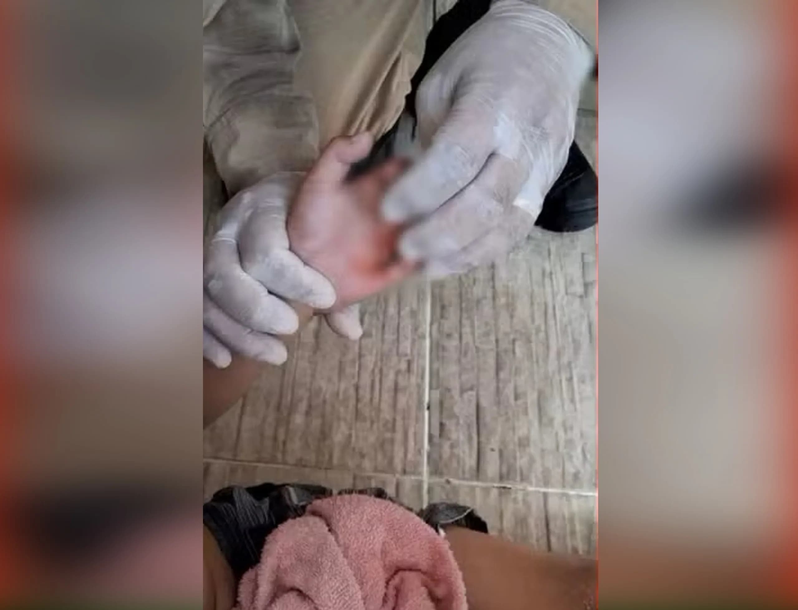 Criança de 6 anos é resgatada após prender a mão em gancho de piscina na Zona Norte de Manaus