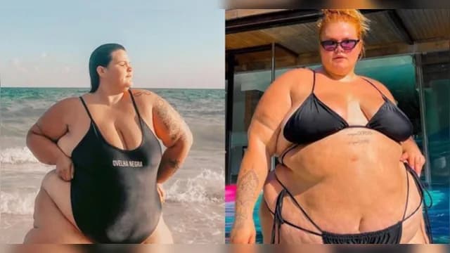 Thais Carla passa por cirurgia bariátrica, diz portal