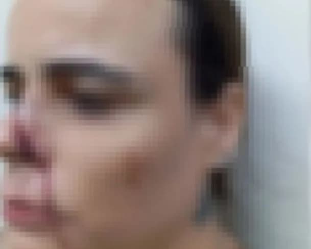 Mulher é espancada por vizinho por causa do latido de cachorros