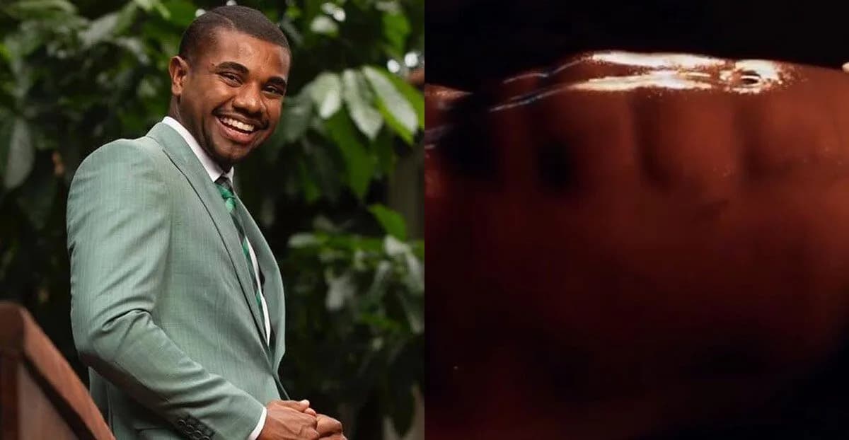 Davi Brito faz lipo HD e internautas criticam &#8220;tanquinho novo&#8221;; veja