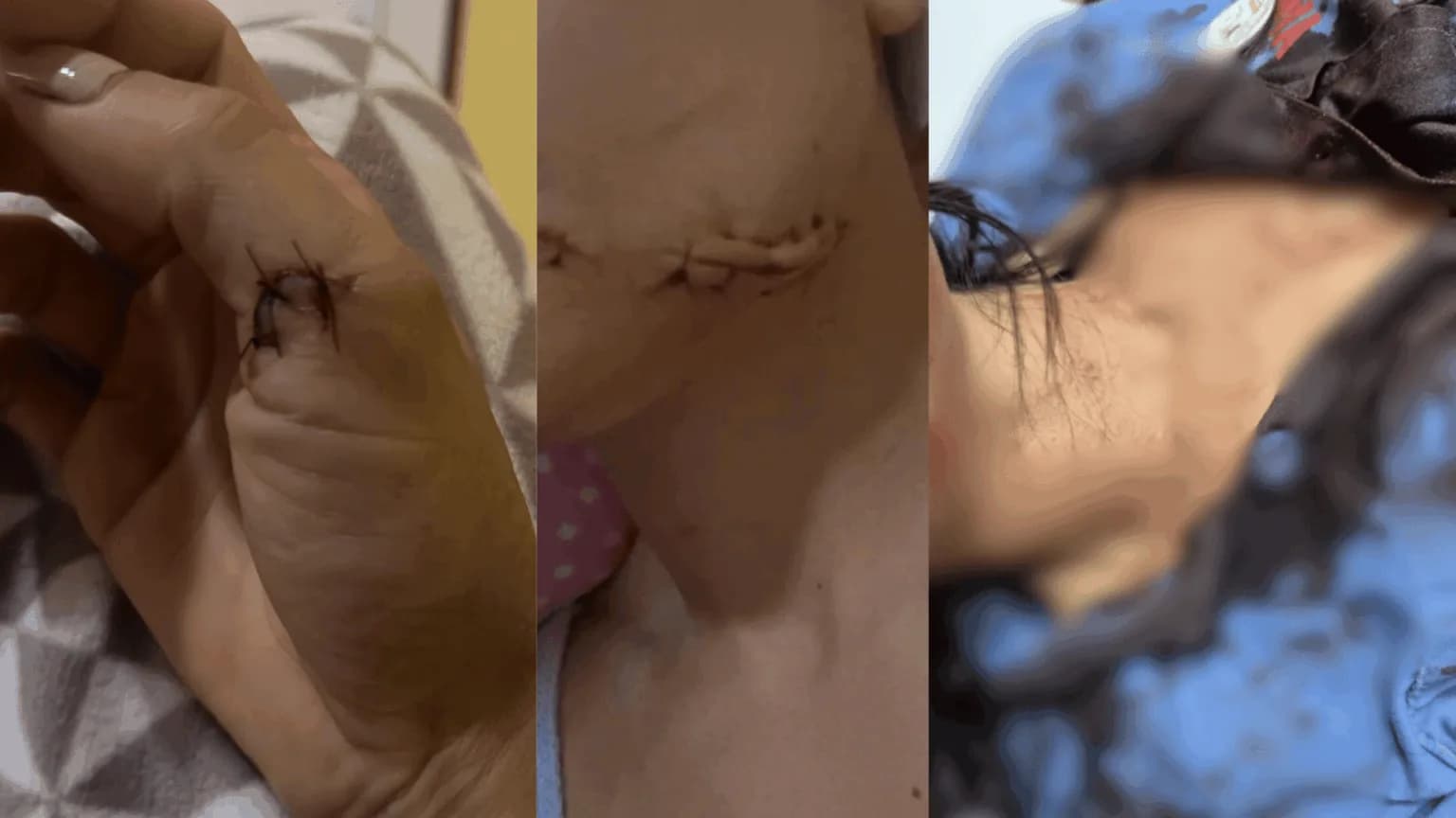 Mulher sofre tentativa de feminicídio por ex não aceitar fim do relacionamento em Manaus