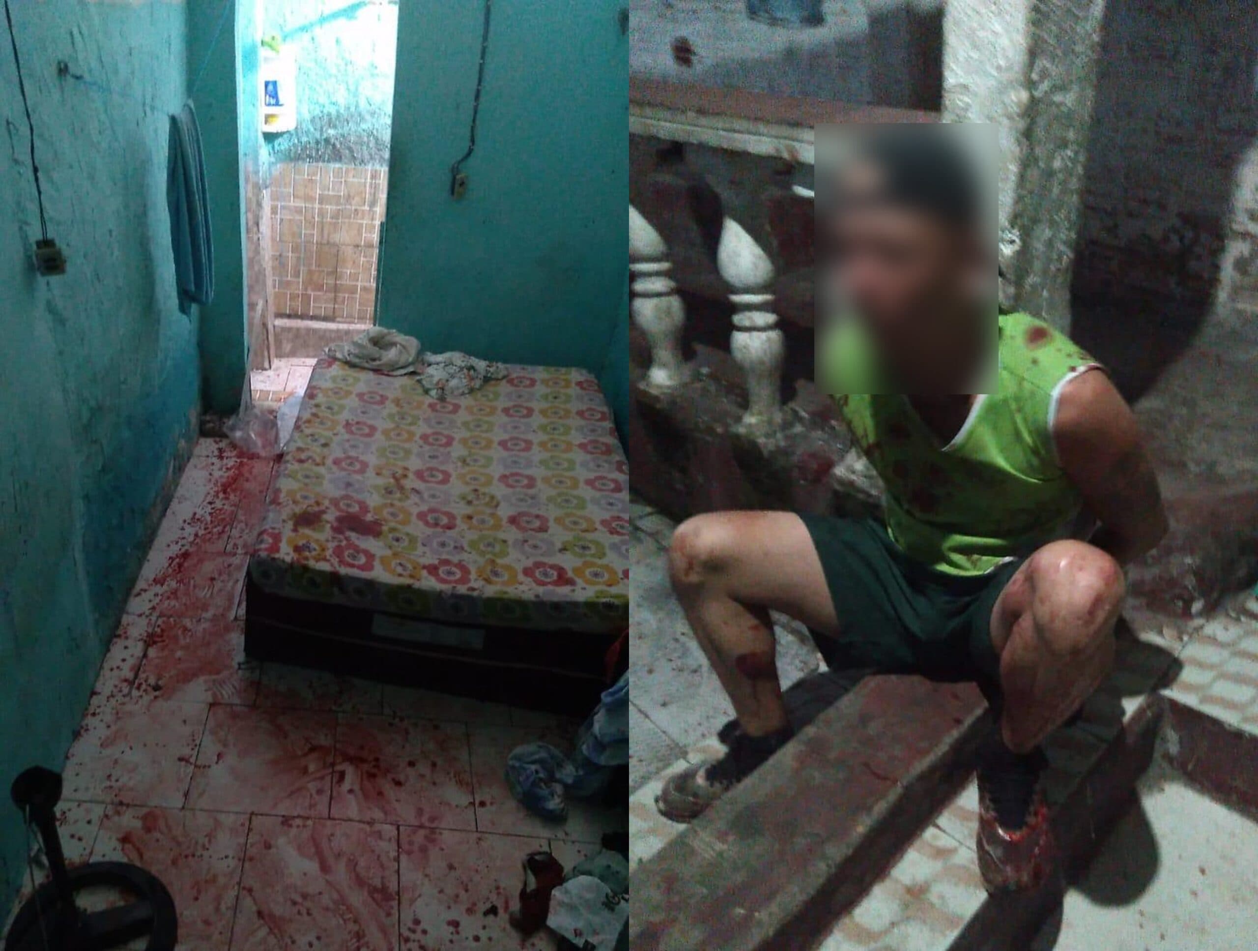 Mulher é vítima de tentativa de feminicídio após ser atacada com faca pelo companheiro no Educandos