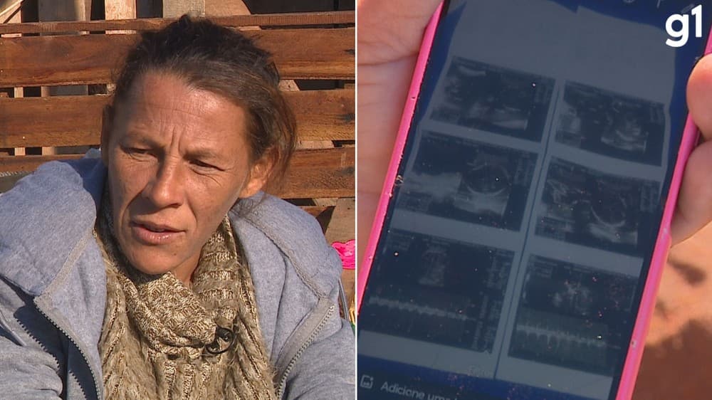 Grávida de gêmeas dá à luz a apenas um bebê no RS; hospital e prefeitura apuram caso