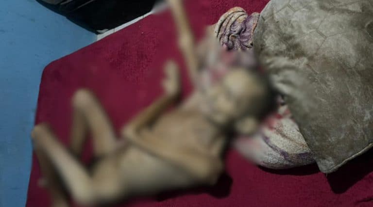 Idoso é achado morto em casa com sinais de abandono e desnutrição em Manaus