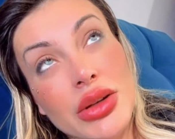 ”Eu achei que ia ficar cega”, se queixa Andressa Urach com fortes dores da cirurgia que mudou cor dos olhos