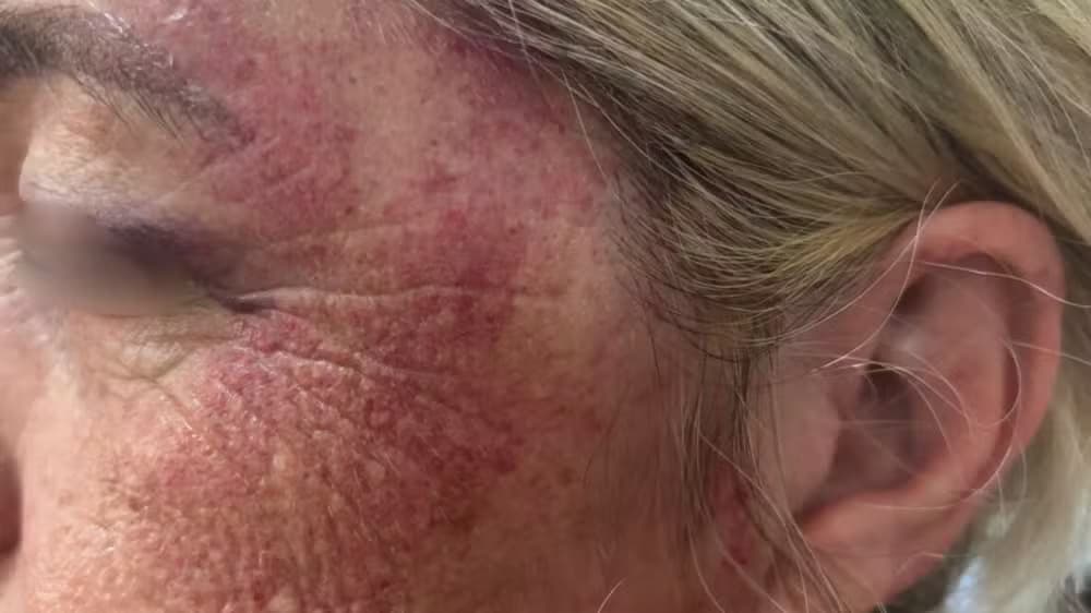 Polícia investiga agressão de padre contra mulher durante suposto exorcismo no interior de SP