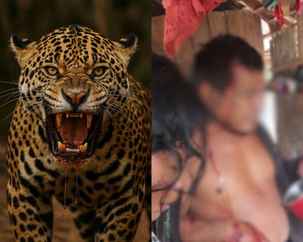 Ataque de onça-pintada deixa homem com couro cabeludo dilacerado em Lábrea