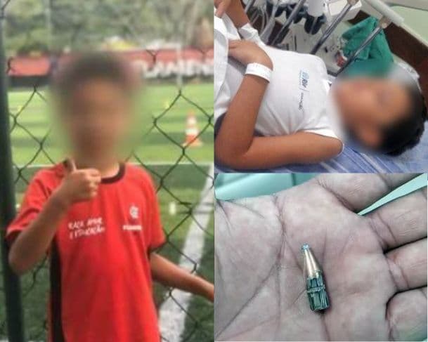 Menino de 7 anos é baleado dentro de escola municipal na Zona Oeste do Rio
