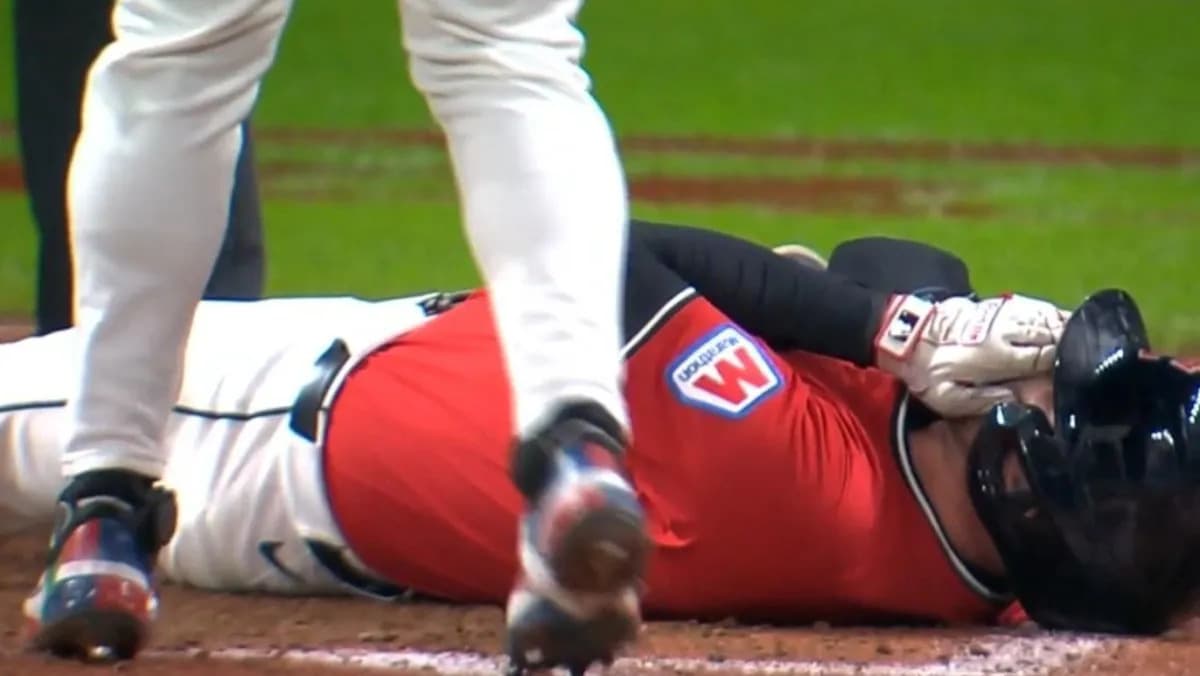 VÍDEO: Jogador de beisebol leva bolada no rosto a 159 km/h e é hospitalizado, nos EUA